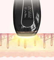Close-up of a permanent IPL hair removal device with LCD screen emitting light on skin for effective hair removal.