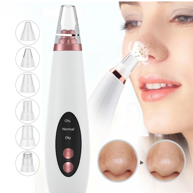 Electric Blackhead Vacuum Cleaner